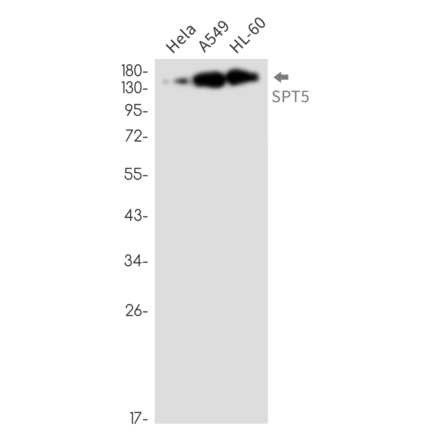 SPT5 Rabbit mAb